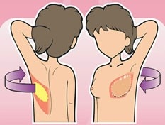 Public Photos / Files - Surgery Fig3