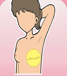 Public Photos / Files - Treatment Fig1