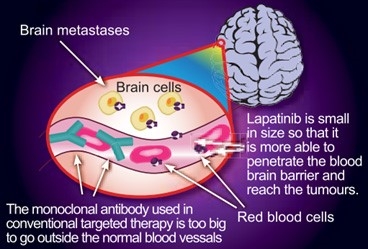 Public Photos / Files - Tykerb